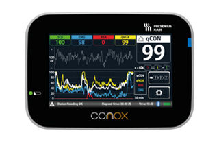 Logo Conox